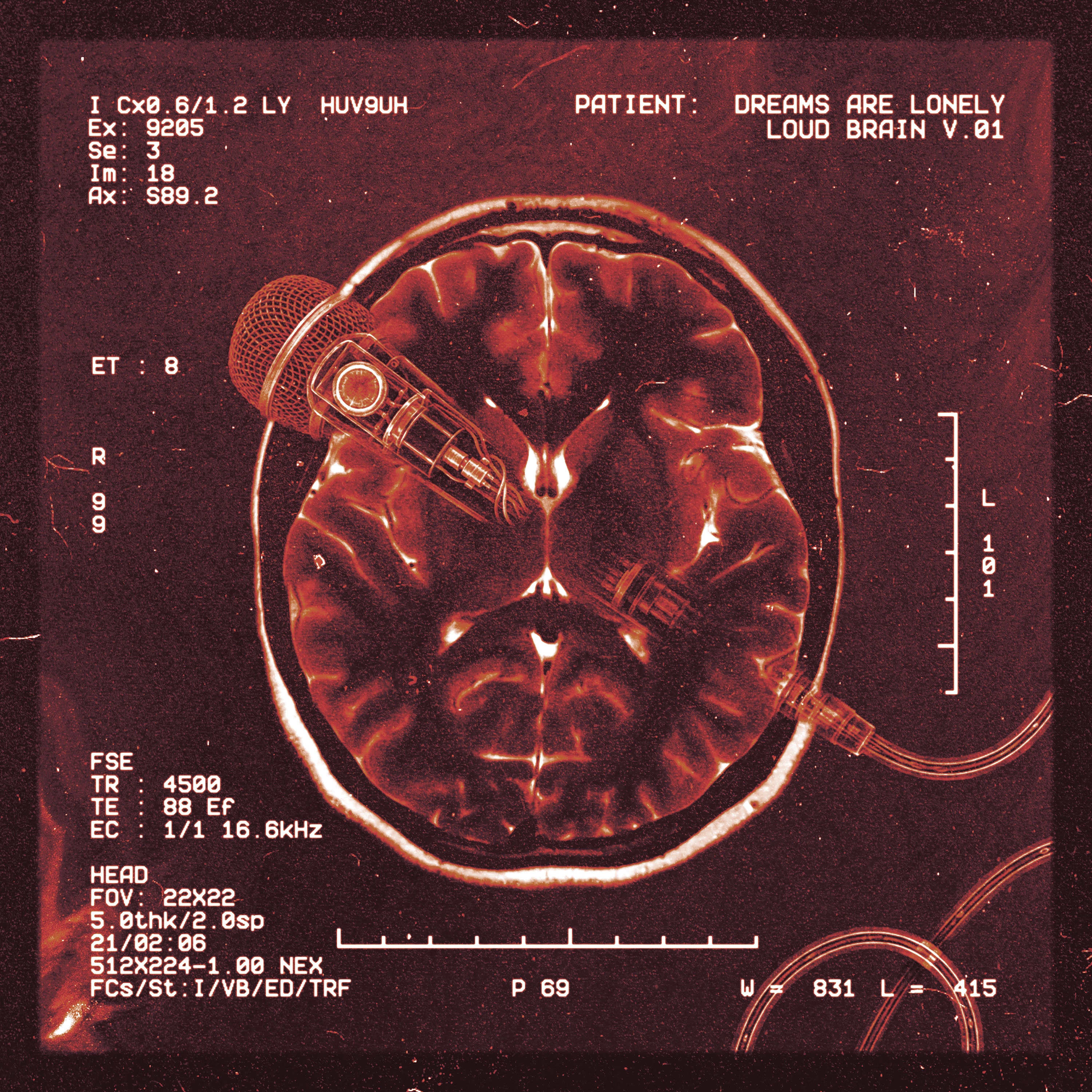 LOUD BRAIN soundtrack artwork
